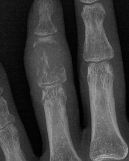 Figure 2 for case Metastatic HCC